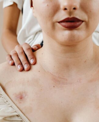 Terapia blizn